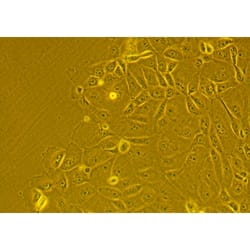 Characterization of commercially available human primary alveolar epithelial cells