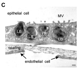 Mechanical strain exacerbates Pseudomonas infection in an organoid-based pneumonia-on-a-chip model