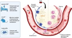 Neutrophil-chemoattractant CXCL5 increases lung barrier permeability in acute lung injury