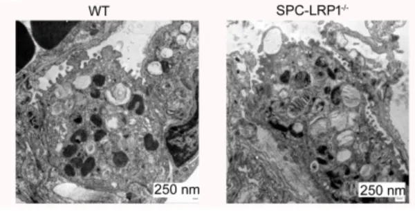 Alveolar type 2 cell LRP1 is needed for surfactant phospholipid metabolism and pulmonary function in mice